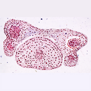 Biological Microscope - Lily Auto Splicing 20x